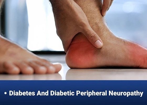 Peripheral Neuropathy and Diabetes