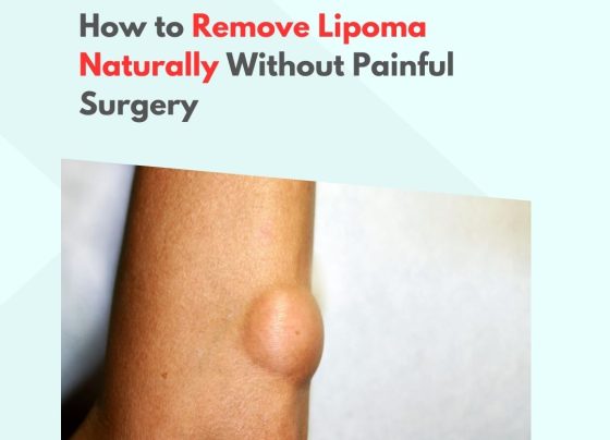 How to Remove Lipoma Naturally Without Painful Surgery