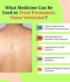 What Medicine Can Be Used to Treat Permanent Tinea Versicolor (1)