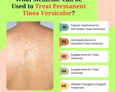 What Medicine Can Be Used to Treat Permanent Tinea Versicolor (1)