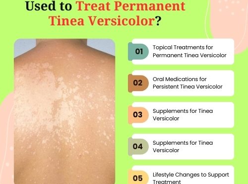 What Medicine Can Be Used to Treat Permanent Tinea Versicolor (1)