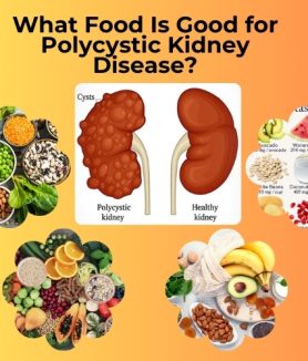 What Food Is Good for Polycystic Kidney Disease