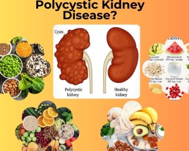 What Food Is Good for Polycystic Kidney Disease