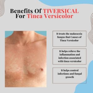 Benefits Of TIVERSICAL For Tinea Versicolor 1